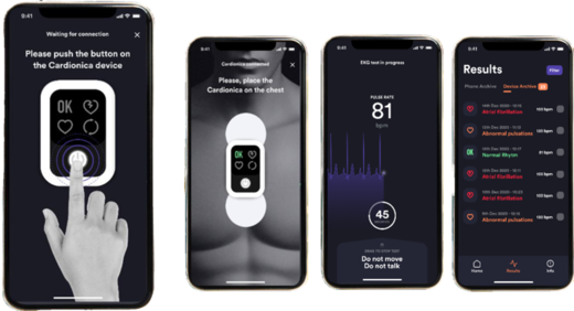 Cardionica - mobil1.png