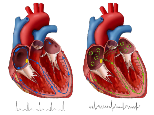 Cardionica - srdce.png