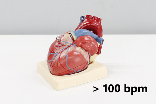Cardionica - Tachykardie.jpg